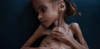 Amal è morta in Yemen a 7 anni per una guerra dimenticata da tutti: lì ci sono due milioni di bambini gravemente denutriti