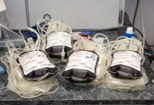 Giornate di donazione sangue, Cub Veneto: finalmente pagate agli operai Forestali Avisp Veneto Donazione di sangue