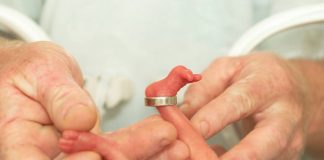 Inquinamento da Pfas, incremento di malattie nei neonati Area Rossa. Il rapporto completo della Regione