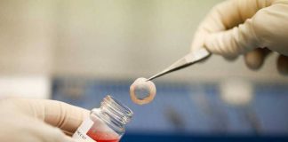 Furto alla Banca degli Occhi, Zaia: “ripugnante”