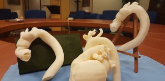 Stampa 3D per il trattamento dell’aorta, l’ospedale S. Bortolo di Vicenza è il primo in Italia
