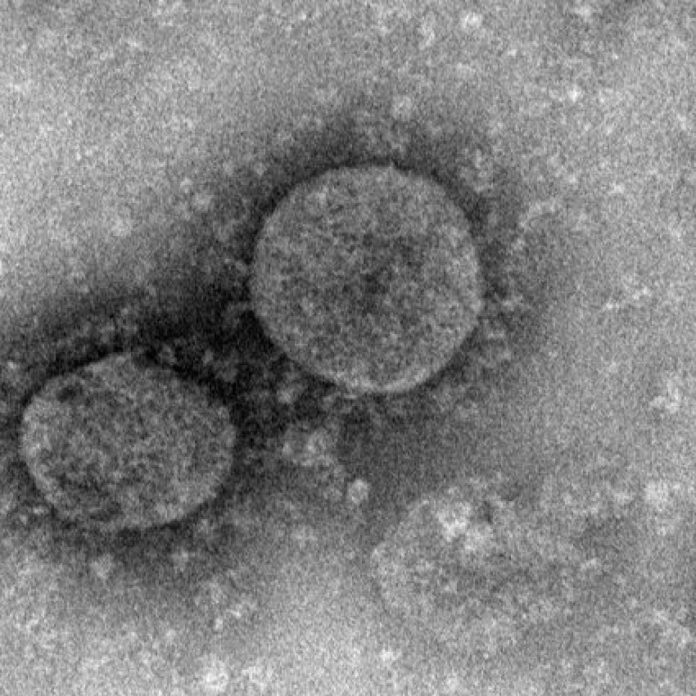 Il coronavirus Covid 19