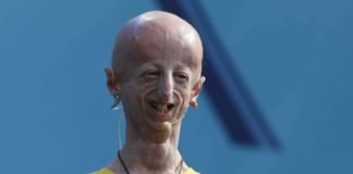 Sammy Basso, un faro per i giovani: dal vasaio della rarità un senso nuovo ai cocci di una malattia impreziosendoli con valori rari Sammy Basso