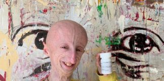 Sammy Basso, presidente regione Veneto Zaia e presidente provincia Vicenza Nardin: esempio di vita che continuerà a ispirare Sammy Basso farmaco progeria