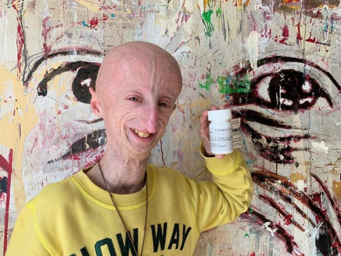Sammy Basso farmaco progeria