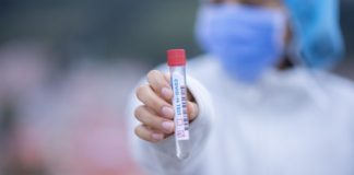 Covid, Rezza: “in Veneto tasso positività 18%”. Regione smentisce: “è 6,30%” test rapido coronavirus