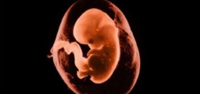 Diritto alla vita dell'embrione