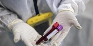 Super gonorrea resistente agli antibiotici, è allarme in Europa