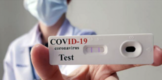 Covid, ministero salute a regione Veneto: possibile utilizzare test antigenici per definizione infezione e per termine auto-sorveglianza Covid, test antigenici