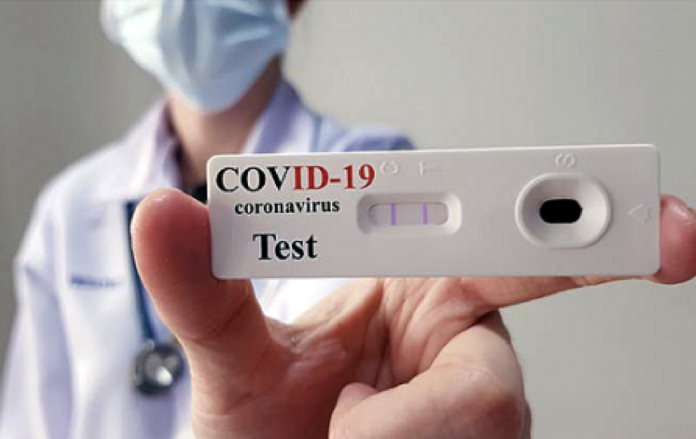 Covid, test antigenici