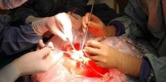 Trapianti, a Padova impiantato il fegato di una 99enne: la donatrice più anziana di sempre