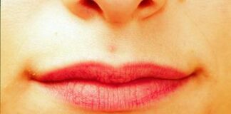 Terapia genica contro l’herpes labiale: cura sperimentale elimina il 90% del virus