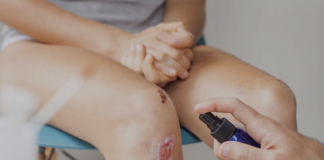 Vulnologia in pratica sulle lesioni da pressione: corso ECM Accademia di Medicina di Torino con lo Studio MT Cavallo STP di Cuneo Vulnologia