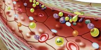 Rotzo e Stoccareddo paesi colesterolo free: è una questione di Dna. Presentata in Provincia di Vicenza ricerca genetica colesterolo
