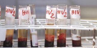 Aids, 120mila infezioni e 76mila morti fra gli under 14 nel 2023