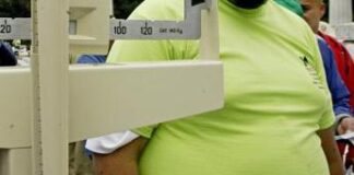 Altro che dottor Nowzaradan, contro l’obesità l’innovazione parla italiano