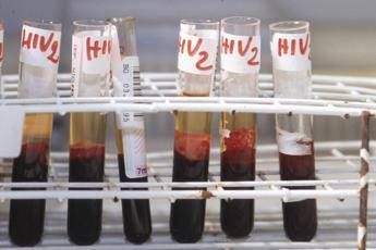Salute, da Hiv a infezioni sessuali lotta a sommerso, al via settimana europea test