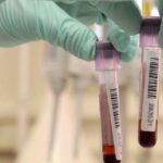 Pfas, Enrico Cappelletti (M5S): “C’è un processo per disastro ambientale, ma studio epidemiologico sparisce. Ministero chiarisca” screening contaminazione pfas analisi del sangue area arancione studio infertitlità