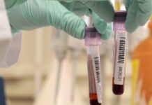 Pfas e Vigili del fuoco, dati allarmanti da indagine Usb e Greenpeace. Masolo (EV): “Avevamo già portato il tema in Regione” screening contaminazione pfas analisi del sangue area arancione studio infertitlità