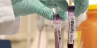 Pfas, indagine epidemiologica ancora nel cassetto. Interrogazione Luisetto – Gruppo Pd: “La Regione vuole finanziarla o fa finta di niente?”. screening contaminazione pfas analisi del sangue area arancione studio infertitlità