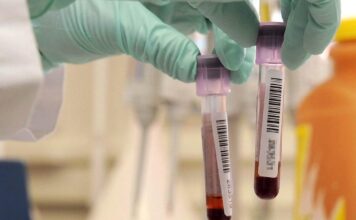 I Pfas riducono gli anticorpi nei bambini vaccinati: uno studio dell’Università di Padova svela il meccanismo screening contaminazione pfas analisi del sangue area arancione studio infertitlità università di padova