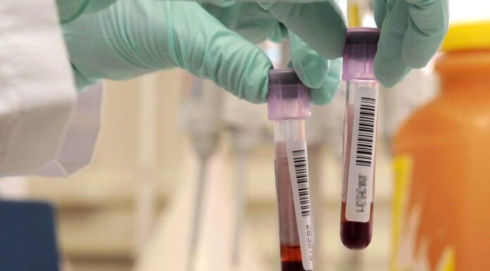 I Pfas riducono gli anticorpi nei bambini vaccinati: uno studio dell’Università di Padova svela il meccanismo screening contaminazione pfas analisi del sangue area arancione studio infertitlità università di padova