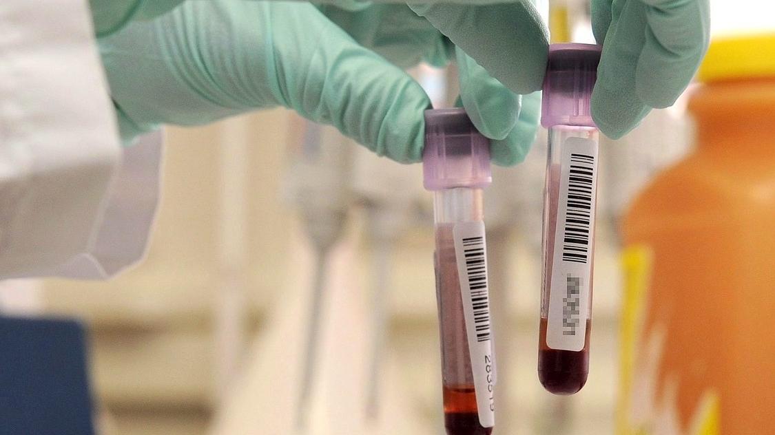 screening contaminazione pfas analisi del sangue area arancione
