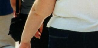 Sanità, al San Raffaele Milano nuovo centro di eccellenza contro l’obesità