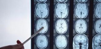 Ricerca, test su micro sensore gel, fa il check-up al cervello e si dissolve