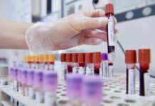 Dal microbiota una speranza contro l’epilessia resistente, lo studio italiano