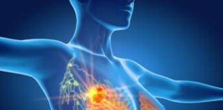 Per cancro seno la cura che arriva dal gelo, Ieo: “Verso un futuro no bisturi”