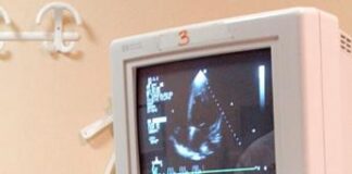 Studio Bambino Gesù, per 9% giovani atleti anomalie in Ecg