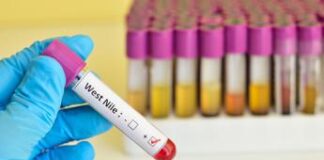 Viaggiare in sicurezza, da vaccini a farmaci i consigli per zone a rischio