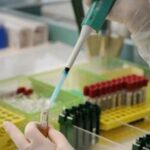 Demenza, verso test per predirla 10 anni prima