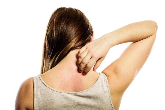 Linfoma cutaneo a cellule T, esperta: “Diagnosi difficile per sintomi dermatologici”