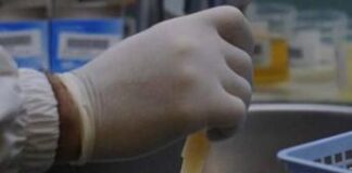 Pancreas, scoperta impronta digitale molecolare delle lesioni che annunciano tumori