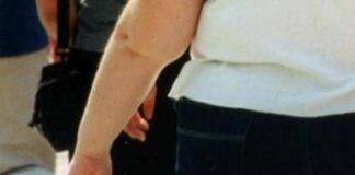 Una morte per malattie infettive su 10 è legata all’obesità, lo studio