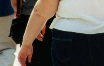 Una morte per malattie infettive su 10 è legata all’obesità, lo studio