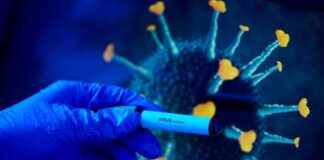 Covid, nuova variante ipermutata: dal Sudafrica arriva Ba.2.87.1