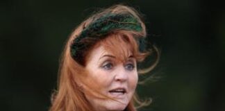 Sarah Ferguson ha un cancro alla pelle