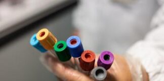 Svelare l’Alzheimer 15 anni prima dei sintomi, la speranza in un esame del sangue