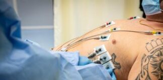 Sindrome di Brugada: cura italiana libera dal rischio di morte improvvisa