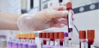 Cancro alla vescica, scoperto ‘interruttore’ molecolare utile per nuove cure