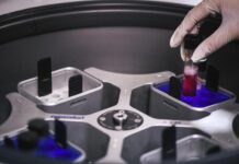 Cisl Vicenza denuncia carenza tecnici di laboratorio Ulss 7 Pedemontana: “A rischio i servizi” hiv tecnici di laboratorio