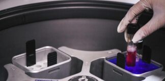 Cisl Vicenza denuncia carenza tecnici di laboratorio Ulss 7 Pedemontana: “A rischio i servizi” hiv tecnici di laboratorio