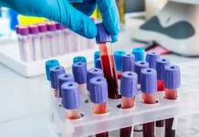 Infezioni da West Nile e donazioni di sangue, la Regione Veneto rassicura: monitoraggio costante per tutta l’estate In rete pazienti e donatori di tutte le ulss venete, si parte da vicenza west nile chikungunya nel veronese