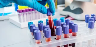 Infezioni da West Nile e donazioni di sangue, la Regione Veneto rassicura: monitoraggio costante per tutta l’estate In rete pazienti e donatori di tutte le ulss venete, si parte da vicenza west nile chikungunya nel veronese