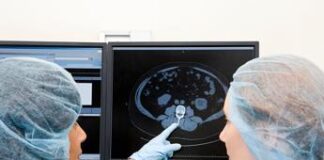 Kinsella e il cancro al cervello, cos’è il glioblastoma che l’ha colpita