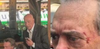 Barillari picchiato da Depardieu in via Veneto: il fotoreporter in ospedale