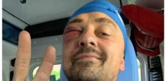 Chef Rubio aggredito sotto casa: “Mi hanno massacrato di botte”